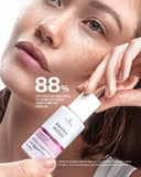 Kinelyn Loção Ultrassecativa PARA PELES COM ACNE FPS 30 Tonalizante TULIPIA